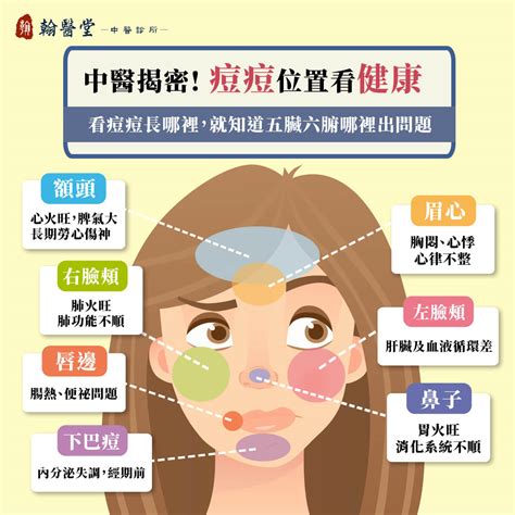 眼皮長痘痘代表什麼|針眼、麥粒腫傻傻分不清？2張表格馬上搞懂 